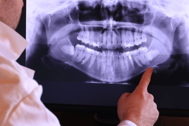 Best Emergency Dentist for Lost Fillings or Crowns in Kenly, NC
