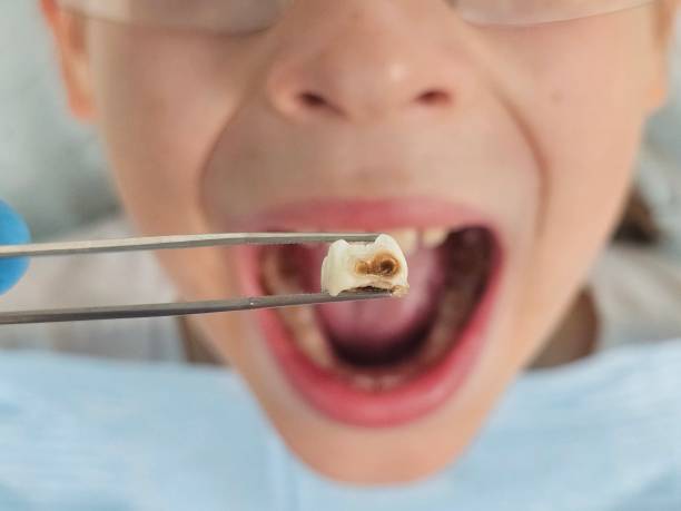 Best Urgent Dental Care for Toothache in Kenly, NC